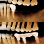 Implant-Testi-Dr-Arthur1