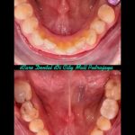 Implant-Testi-Dr-Arthur3
