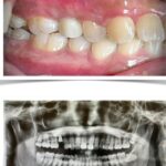 Implant-Testi-Dr-John1
