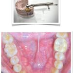 Implant-Testi-Dr-John2
