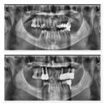 Implant-Testi-Dr-Shaun1