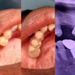 testi-dr-lim-wai-shen2