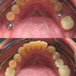 testi-dr-lim-wai-shen3
